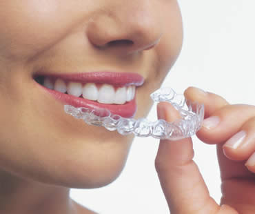 Invisalign for Children: Is It a Good Fit?